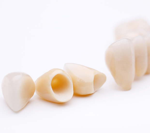 Mamaroneck Dental Crowns and Dental Bridges