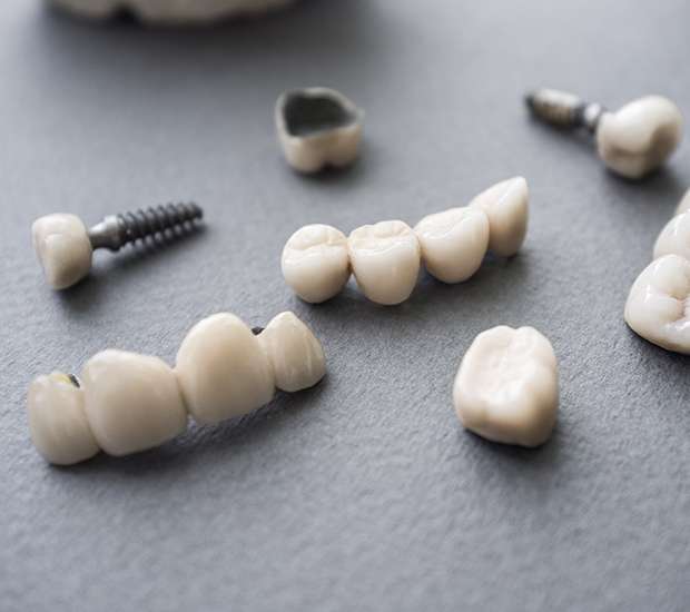 Mamaroneck The Difference Between Dental Implants and Mini Dental Implants